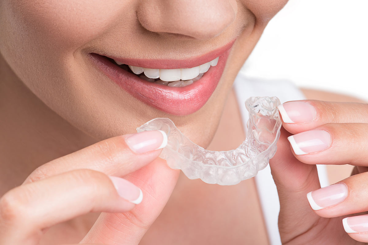 Ortodonzia invisibile con la tecnica invisalign donna