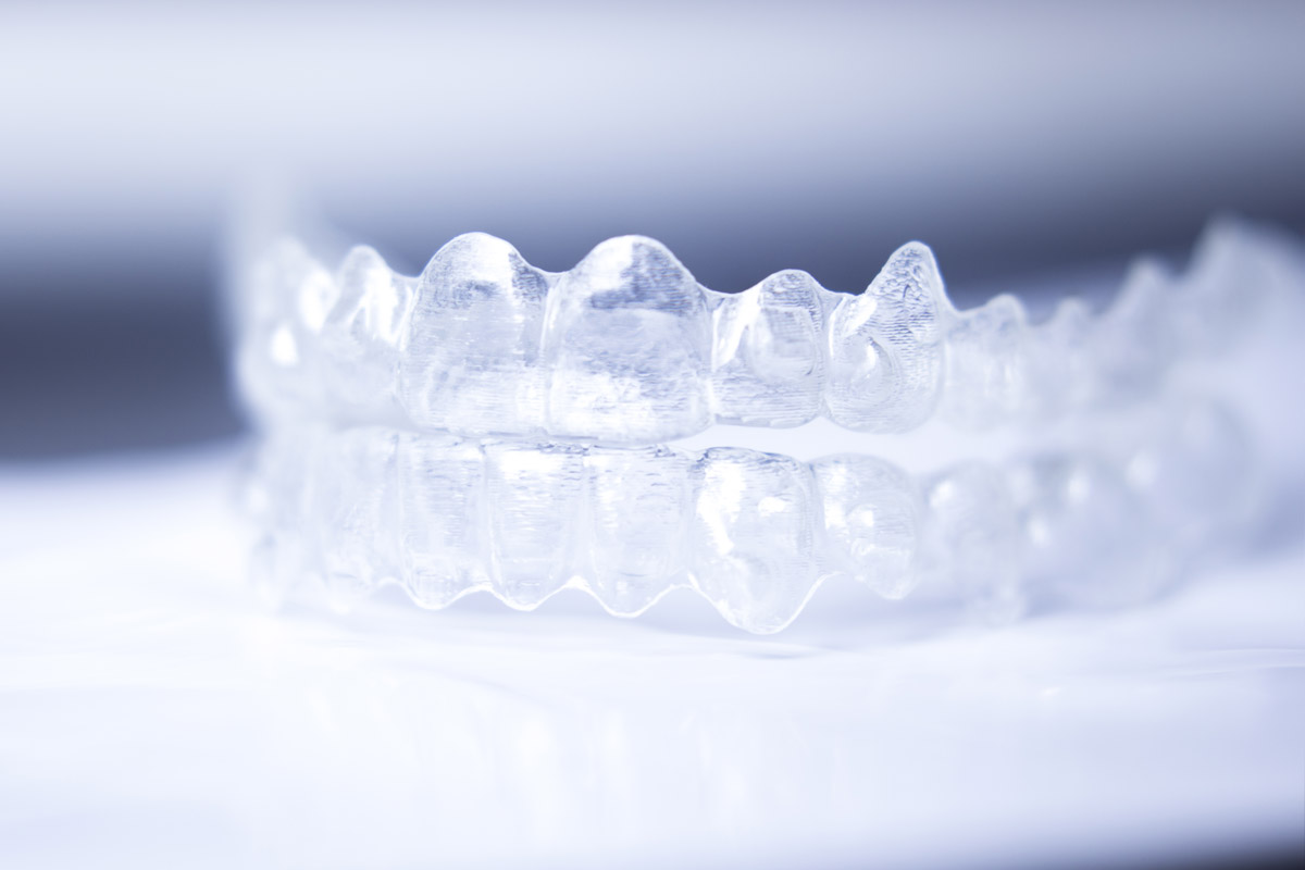 Ortodonzia invisibile con la tecnica invisalign