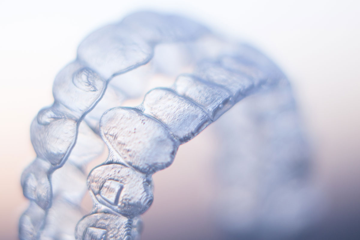 Ortodonzia invisibile con la tecnica invisalign